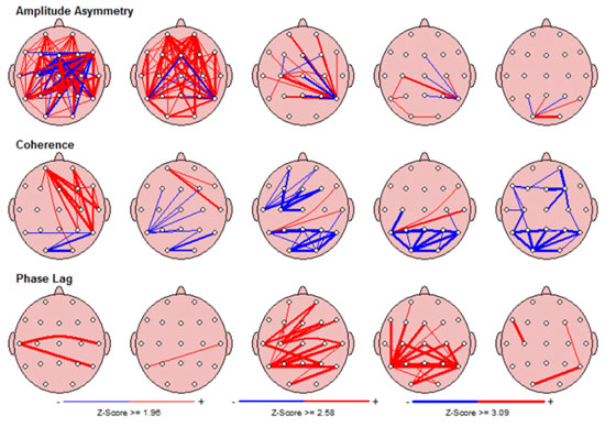 Neurofeedback